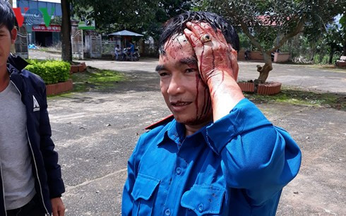  Ông Nguyễn Văn Thuận bị chém rách đầu, đổ máu.