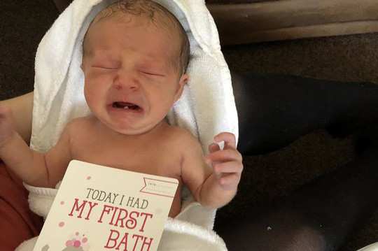 Bé Isla-Rose với chiếc răng có sẵn khi ra đời - ảnh do gia đình cung cấp