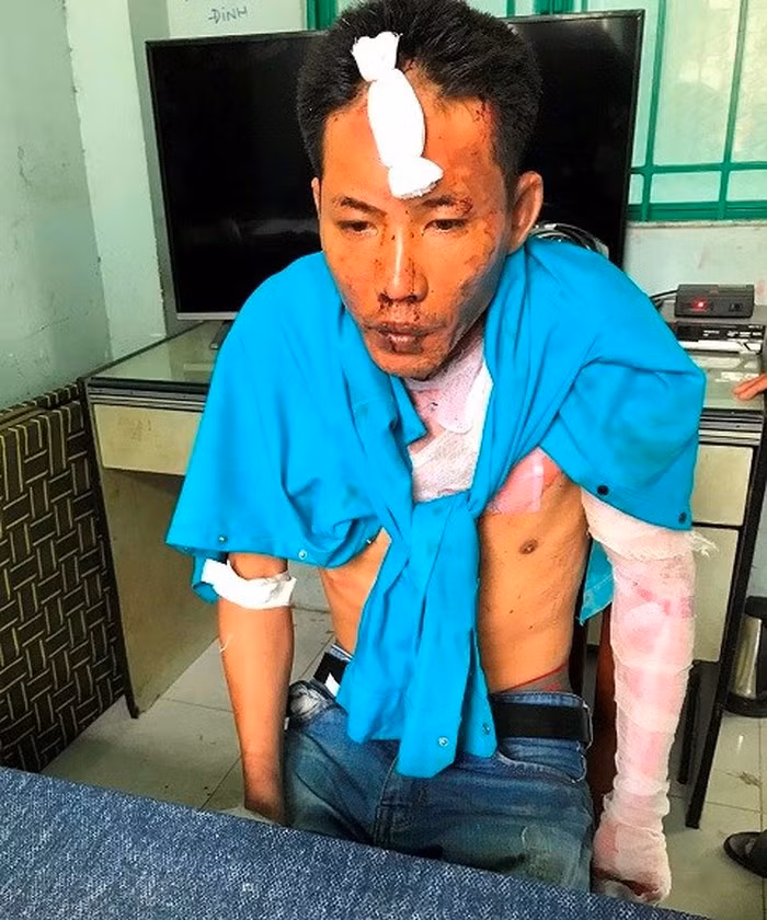 Nghi can Nguyễn Quang Dũng. (Ảnh: báo Đồng Nai)