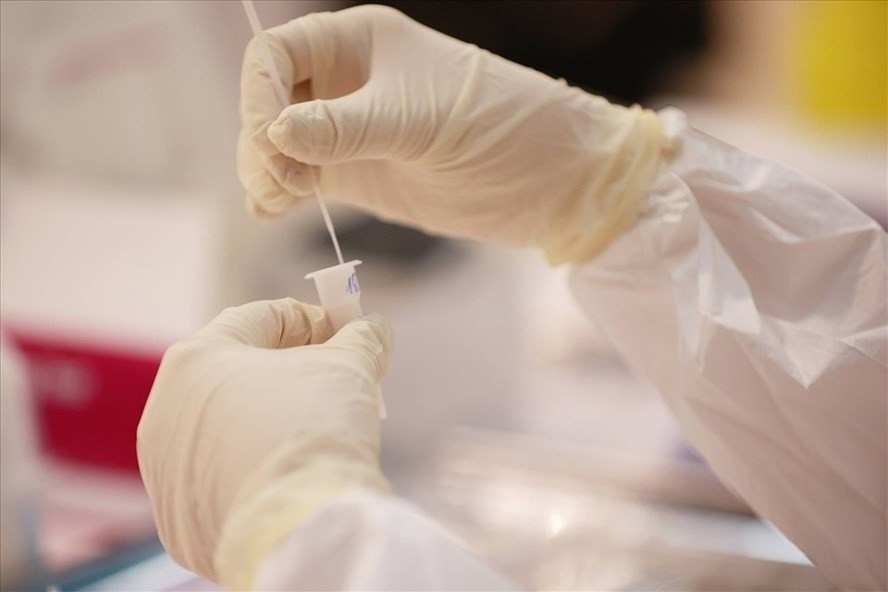 Xét nghiệm SARS-CoV-2. Ảnh: Hải Nguyễn