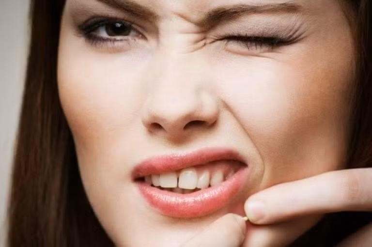 Bổ sung nhiều chất béo tốt như Omega 3 khi xuất hiện mụn trên vùng miệng và mũi. Ảnh: T. L.