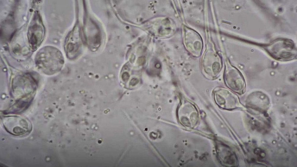  Henneguya salminicola nhìn dưới kính hiển vi - Ảnh chụp màn hình Times of Israel