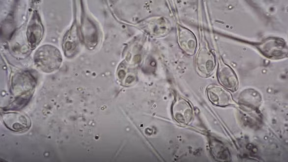  Henneguya salminicola nhìn dưới kính hiển vi - Ảnh chụp màn hình Times of Israel