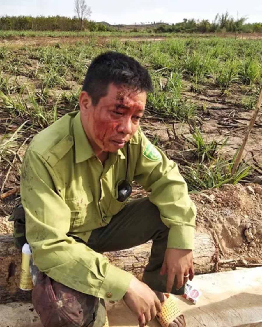 Anh Ngô Lê Nhật Tiến bị lâm tặc đánh toác đầu