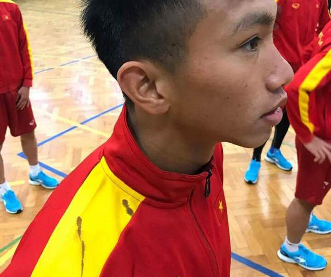 Tấm ảnh đặc biệt của HLV Hoàng Anh Tuấn ghi lại khoảnh khắc cậu út Đoàn Văn Hậu đổ máu khi tập luyện cùng U.19 Việt Nam trước khi vụt lớn trước tuổi/Facebook nhân vật
