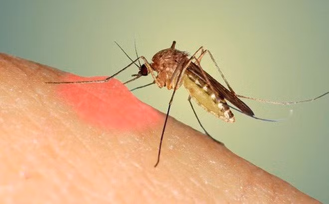 Có thể phòng bệnh sốt xuất huyết bằng cách tránh muỗi đốt, với những mẹo dễ làm. Ảnh: T.L