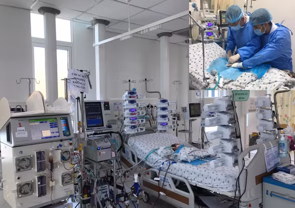 Sau mổ tim bẩm sinh, bé trai sơ sinh rơi vào tình trạng nguy kịch, phải áp dụng đồng thời 2 kỹ thuật ECMO và lọc máu liên tục để bảo vệ tính mạng - Ảnh: Bệnh viện cung cấp