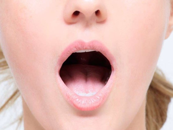 Nếu nhận thấy các vùng dày lên trong miệng có màu trắng hoặc xám và không thể cạo đi, có thể đã phát triển bạch sản, một thay đổi mô có thể dẫn đến ung thư - Ảnh minh họa: Shutterstock Nếu nhận thấy các vùng dày lên trong miệng có màu trắng hoặc xám và không thể cạo đi, có thể đã phát triển bạch sản, một thay đổi mô có thể dẫn đến ung thư - Ảnh minh họa: Shutterstock