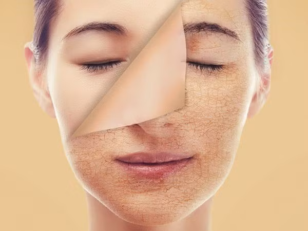 Cách chăm sóc da mùa đông, ảnh minh họa. 