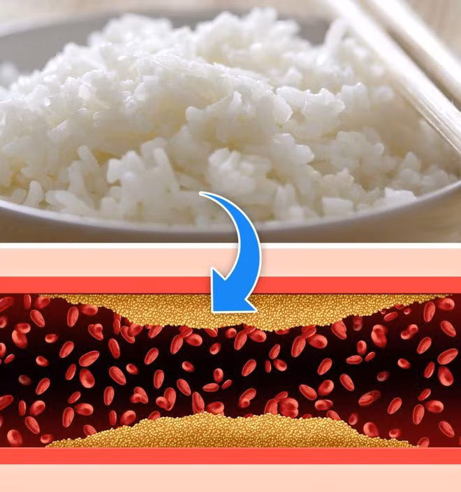 Gạo chứa chất chống viêm tự nhiên, nó ngăn ngừa hình thành mảng bám bên trong mạch máu và giảm nguy cơ mắc một số bệnh về tim, như đau tim hoặc đột quỵ. ẢNH: SHUTTERSTOCK