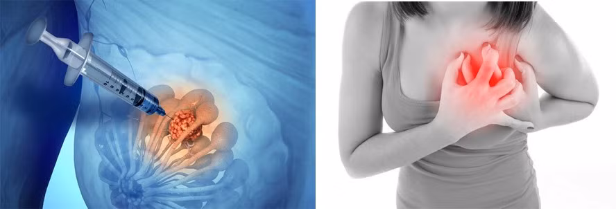 Phương pháp xét nghiệm sinh thiết kim. Đồ họa: Hồng Nhật