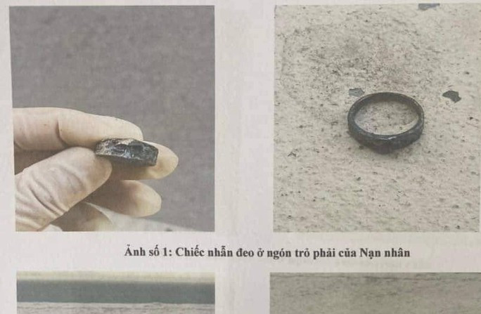 Một số vật chứng thu được trên người nạn nhân Một số vật chứng thu được trên người nạn nhân