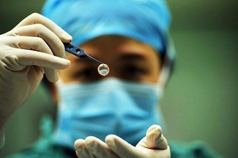 Hiến giác mạc sau khi qua đời là nghĩa cử cao đẹp. Ảnh minh hoạ Hiến giác mạc sau khi qua đời là nghĩa cử cao đẹp. Ảnh minh hoạ