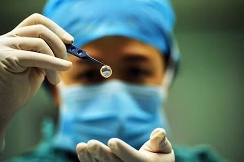 Hiến giác mạc sau khi qua đời là nghĩa cử cao đẹp. Ảnh minh hoạ