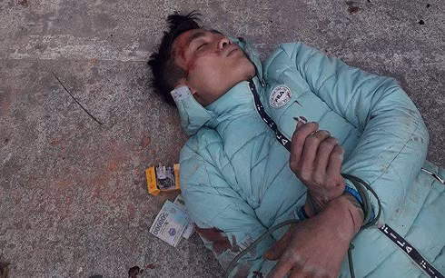  Đối tượng trộm chó bị dân làng bắt sống.