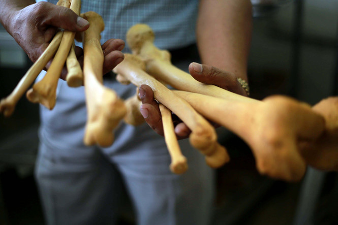 Các mảnh xương chân được anh Nhân xử lý chuẩn bị lắp ghép trở lại.