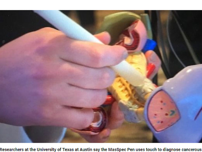 MasSpec Pen có thể phát hiện ung thư chỉ trong 20 giây