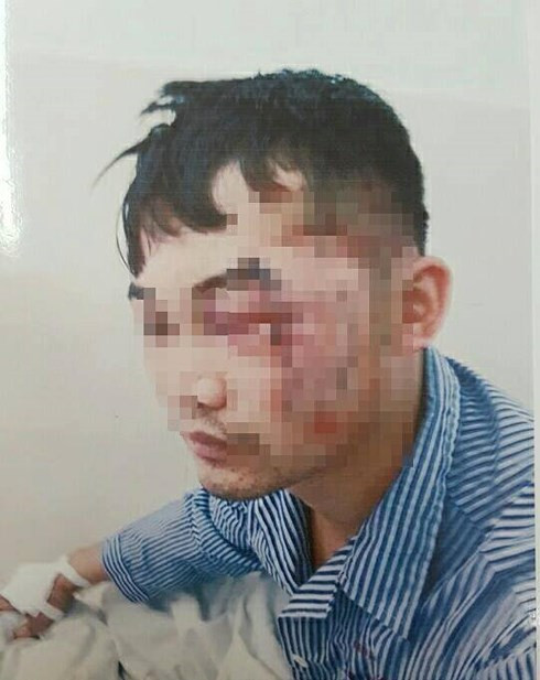Anh Th. điều trị tại bệnh viện với nhiều vết thương.  Anh Th. điều trị tại bệnh viện với nhiều vết thương.