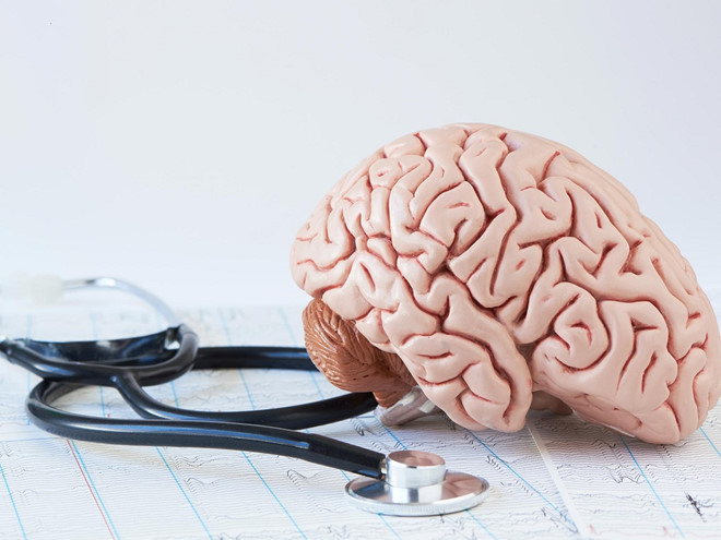 Đột quỵ dễ bị chẩn đoàn sai là tim mạch hoặc chóng mặt thông thường-Ảnh: Shutterstock Đột quỵ dễ bị chẩn đoàn sai là tim mạch hoặc chóng mặt thông thường-Ảnh: Shutterstock