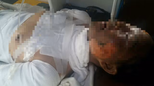 Chị Bé đang cấp cứu trong tình trạng nguy kịch