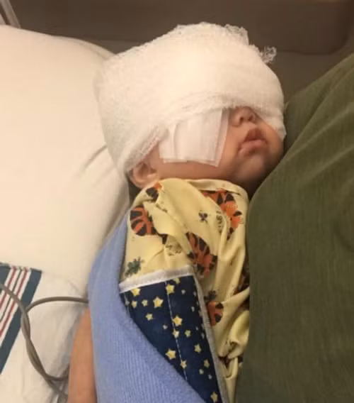 Mehlani phải phẫu thuật lúc năm tháng tuổi để tránh mù lòa. Ảnh: Twitter.