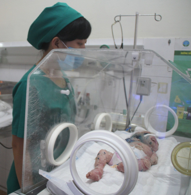 Bé N.H.H. đang được tích cực điều trị tại Bệnh viện Nhi đồng Đồng Nai.