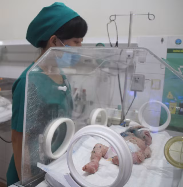 Bé N.H.H. đang được tích cực điều trị tại Bệnh viện Nhi đồng Đồng Nai. Bé N.H.H. đang được tích cực điều trị tại Bệnh viện Nhi đồng Đồng Nai.