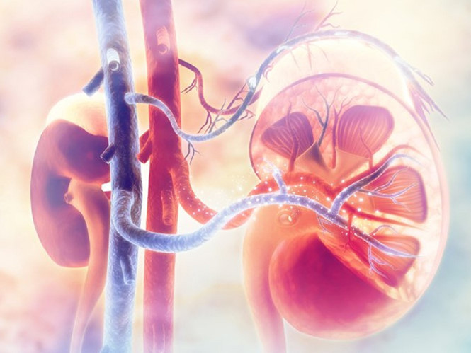  Bệnh nhân tiểu đường cần chú ý đến sức khỏe thận vì khoảng 50% sẽ bị tổn thương thận khi tiểu đường tiến triển đến giai đoạn cuối