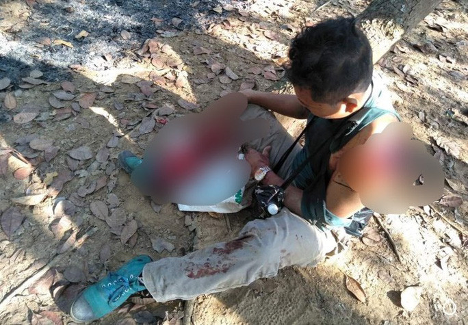 Nạn nhân lúc ở bìa rừng chuẩn bị đưa đi cấp cứu