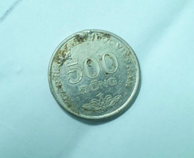 Đồng xu được nội soi gặp ra từ trong ổ bụng bé gái- Ảnh: TRẦN THANH PHONG Đồng xu được nội soi gặp ra từ trong ổ bụng bé gái- Ảnh: TRẦN THANH PHONG