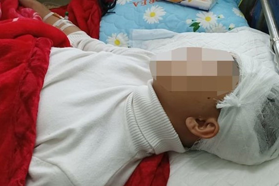 Nam sinh Phan Thanh L. bị bạn cùng trường đánh vỡ sọ não. Ảnh gia đình cung cấp