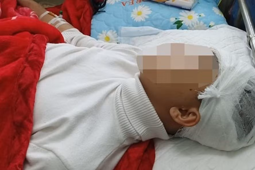 Nam sinh Phan Thanh L. bị bạn cùng trường đánh vỡ sọ não. Ảnh gia đình cung cấp