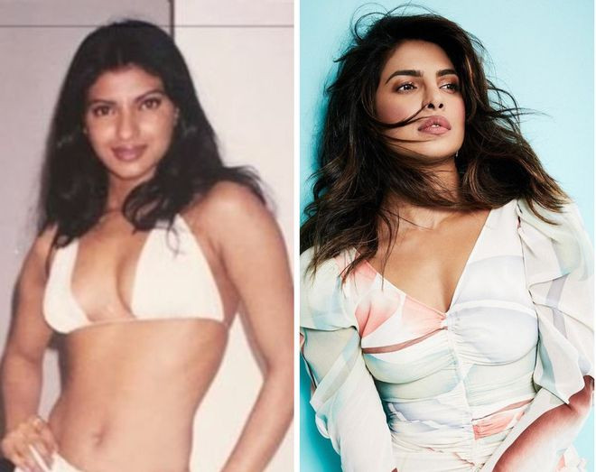 Priyanka Chopra thừa nhận việc sửa mũi đã thay đổi hoàn toàn gương mặt cô ẢNH: INSTAGRAM NV