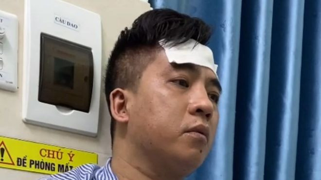 Nghi phạm Nguyễn Việt Hùng. ẢNH CÔNG AN CUNG CẤP