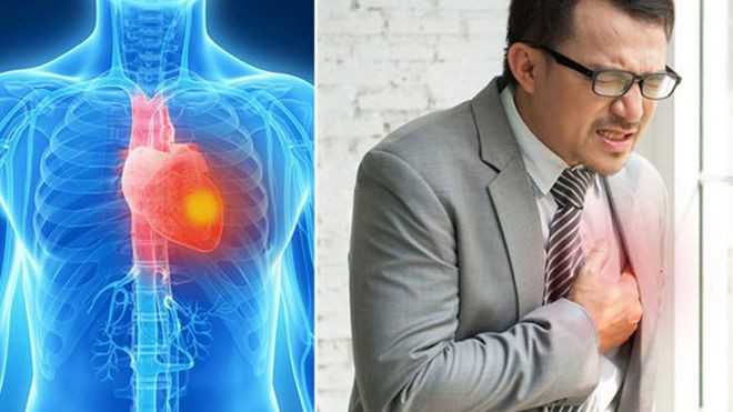Các triệu chứng của một cơn đau tim bắt đầu xuất hiện rất lâu trước khi cơn đau tim thực sự xảy ra nhưng điều này hầu như không được chú ý - Ảnh: Shutterstock Các triệu chứng của một cơn đau tim bắt đầu xuất hiện rất lâu trước khi cơn đau tim thực sự xảy ra nhưng điều này hầu như không được chú ý - Ảnh: Shutterstock