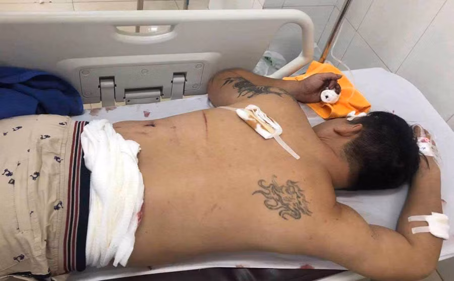 Dũng đã bị Thành dùng dao chém gây thương tích. Ảnh: Văn Ngọc