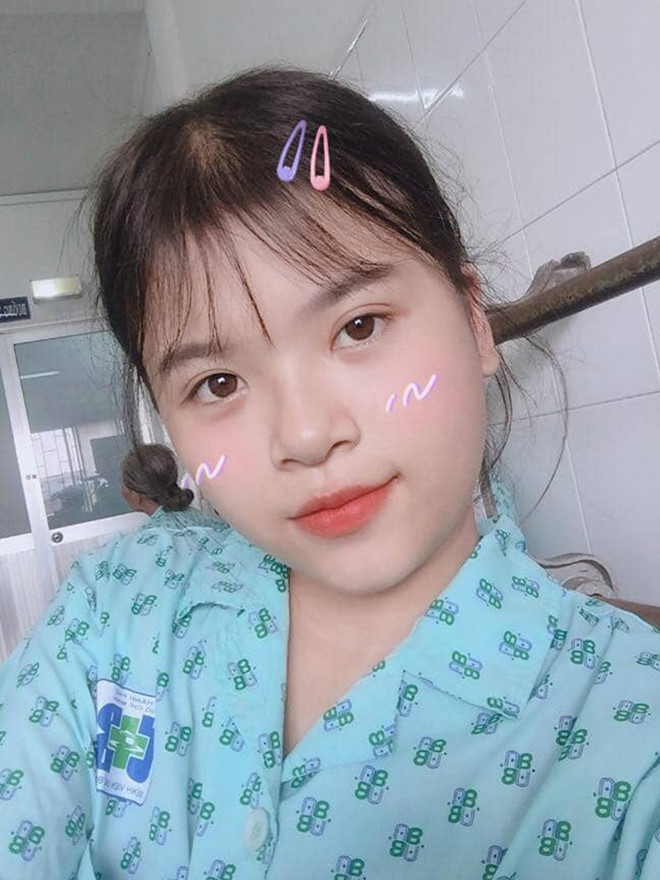 Quá trình hóa trị đã khiến tóc của Hồng Anh rụng hết, nhưng gương mặt của cô vẫn giữ được nét đáng yêu, tinh nghịch của tuổi đôi mươi Quá trình hóa trị đã khiến tóc của Hồng Anh rụng hết, nhưng gương mặt của cô vẫn giữ được nét đáng yêu, tinh nghịch của tuổi đôi mươi