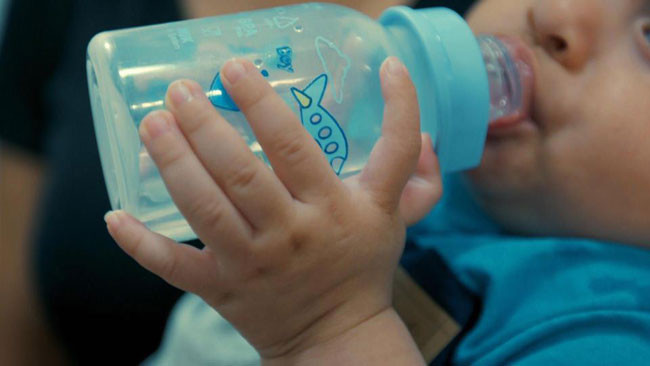 Bé trai Vinicius mới chào đời cũng có bàn tay 6 ngón.