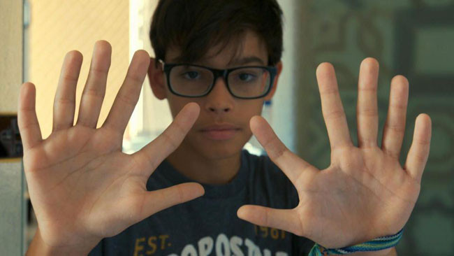 Gia đình De Silva được mệnh danh là gia đình 6 ngón.