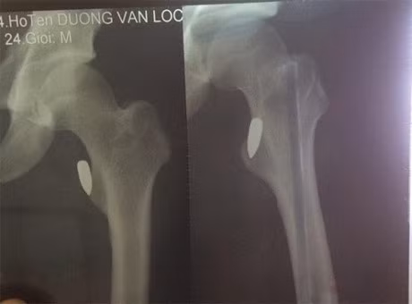 Hình chụp vết thương của nạn nhân.