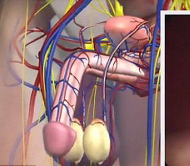 Hiện tượng nguy hiểm xảy ra khi các động mạch và tĩnh mạch (màu đỏ và xanh) khu vực hạ bộ bị tắc nghẽn, dẫn đến ứ đọng, tạo ra sự cương cứng vô cảm hoặc đau đớn - ảnh: DAILY MAIL