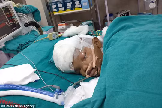 1 ngày sau phẫu thuật, mới chỉ có 1 trong 2 bé hồi tỉnh - ảnh do bệnh viện cung cấp. 1 ngày sau phẫu thuật, mới chỉ có 1 trong 2 bé hồi tỉnh - ảnh do bệnh viện cung cấp.