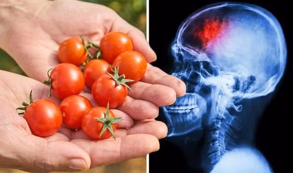 Theo nghiên cứu, ăn nhiều cà chua giúp giảm một cách thần kỳ 55% nguy cơ đột quỵ. Ảnh: Shutterstock Theo nghiên cứu, ăn nhiều cà chua giúp giảm một cách thần kỳ 55% nguy cơ đột quỵ Shutterstock