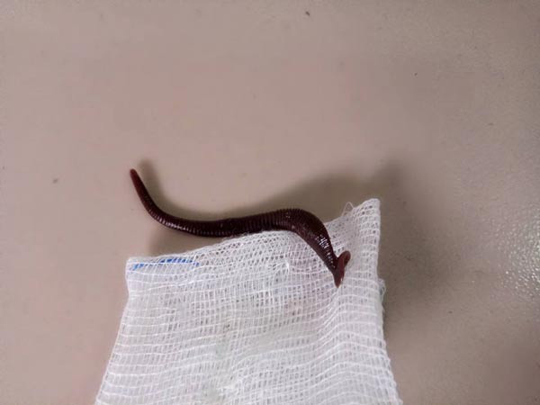 Con vắt rừng dài 5 cm được gắp ra khỏi mũi cháu bé 12 tháng tuổi ở huyện miền núi Quảng Trị. Con vắt rừng dài 5cm được gắp ra khỏi mũi cháu bé 12 thánh tuổi ở huyện miền núi Quảng Trị