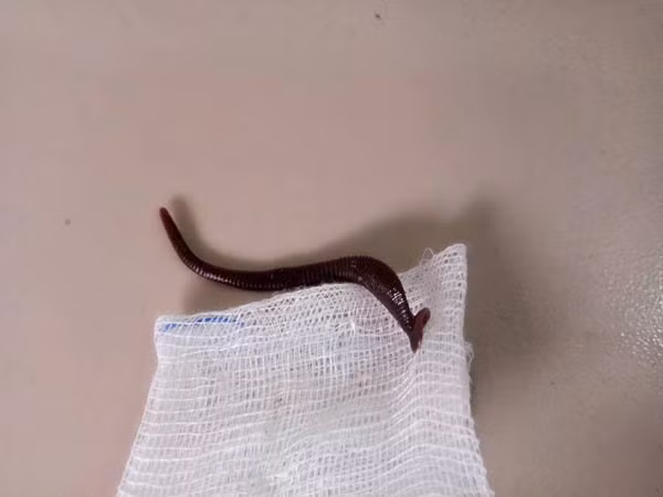 Con vắt rừng dài 5cm được gắp ra khỏi mũi cháu bé 12 thánh tuổi ở huyện miền núi Quảng Trị