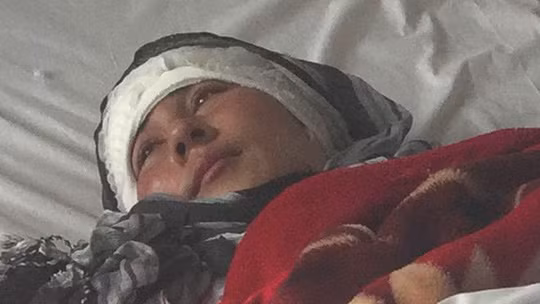 Zarina - hiện điều trị chấn thương tại bệnh viện và đang trong tình trạng ổn định. Ảnh: BBC