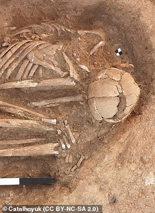 Hộp sọ một hài cốt bị nứt toác - ảnh do nhóm nghiên cứu cung cấp