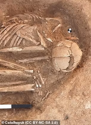 Hộp sọ một hài cốt bị nứt toác - ảnh do nhóm nghiên cứu cung cấp