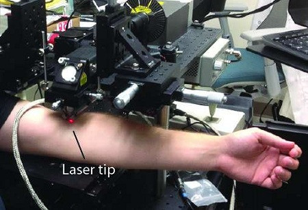 Thử nghiệm công nghệ Cytophone trên người Thử nghiệm công nghệ Cytophone trên người