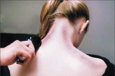 Cạo gió đúng cách! ảnh 1 Cạo gió đúng cách! ảnh 1